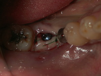PICT0005.JPG