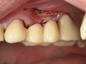 PICT0042.JPG