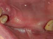 PICT0043.JPG