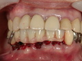PICT0015.JPGのサムネール画像のサムネール画像のサムネール画像