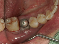 PICT0117.JPG