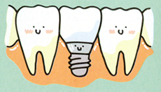 インプラント治療とは？